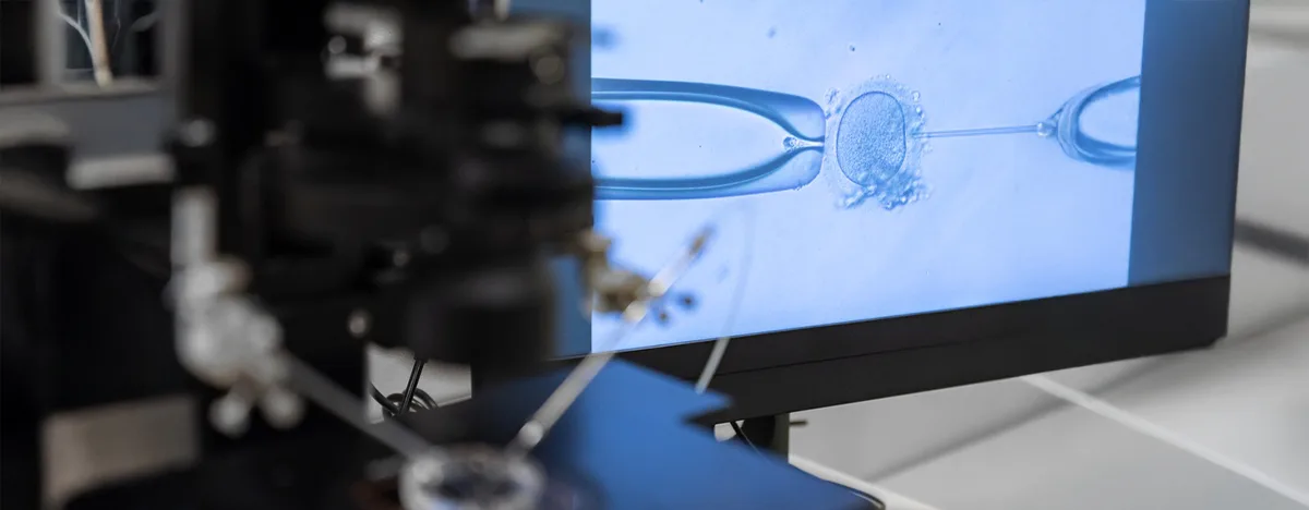 Calcium Ionophore in IVF