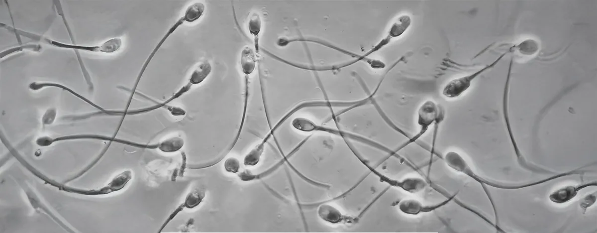 IMSI Technique and IVF