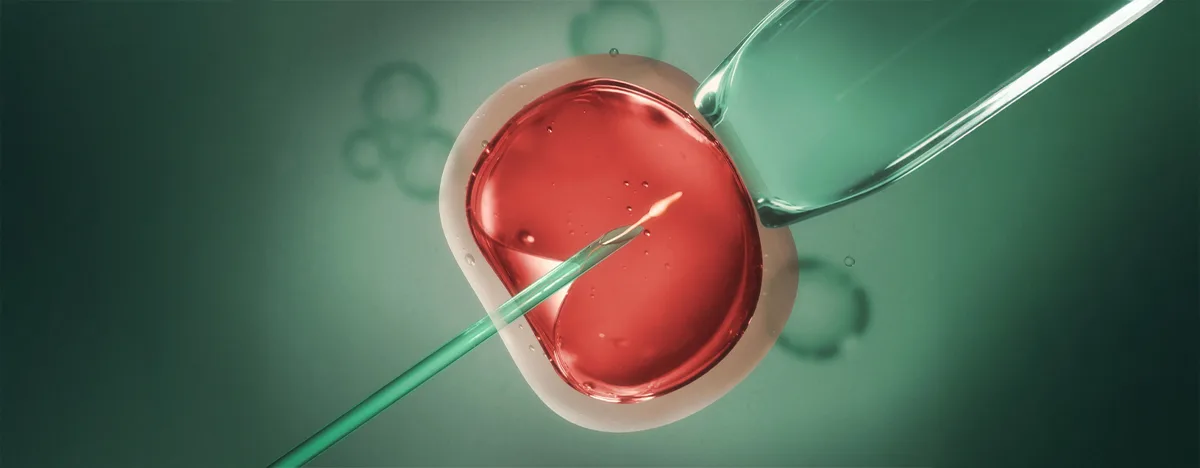 Micro Chip in IVF