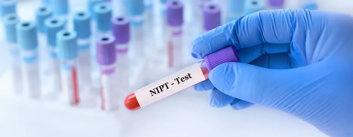 NIPT Test