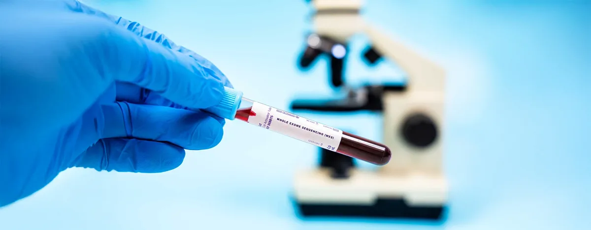 Whole Exome Sequencing (WES) Test