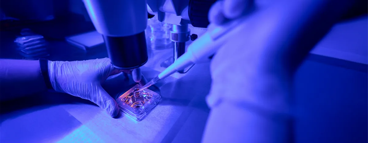 Whole Genome Sequencing (WGS) Test