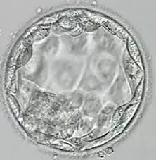 Blastocyst Transfer