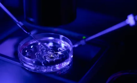 Intracytoplasmic Sperm Injection (ICSI)