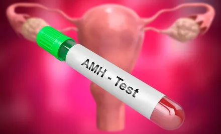 What Is the AMH Test? Ovarian Reserve, OHSS Risk, and Its Role in IVF Treatment