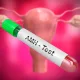 What Is the AMH Test? Ovarian Reserve, OHSS Risk, and Its Role in IVF Treatment