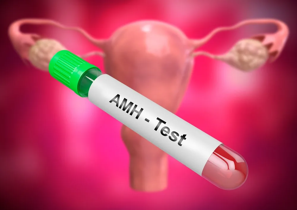 What Is the AMH Test? Ovarian Reserve, OHSS Risk, and Its Role in IVF Treatment
